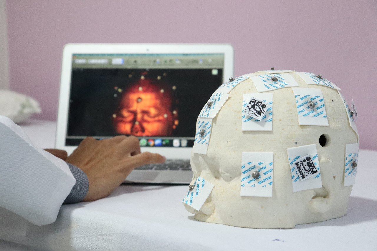 Tecnologia utiliza inteligência artificial em neurocirurgias menos invasivas. Foto: Josafá Neto/Rádio UFS